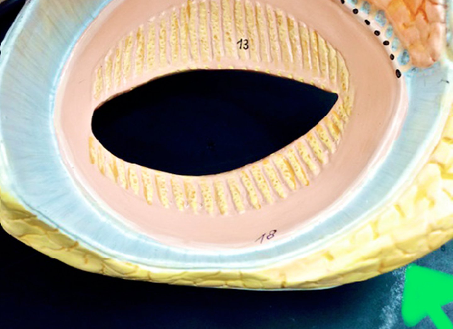 <p>Identify the structure the green arrow is pointing at.</p>