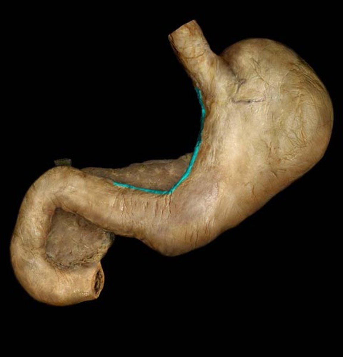 <p>The smaller, concave border of the stomach.</p>