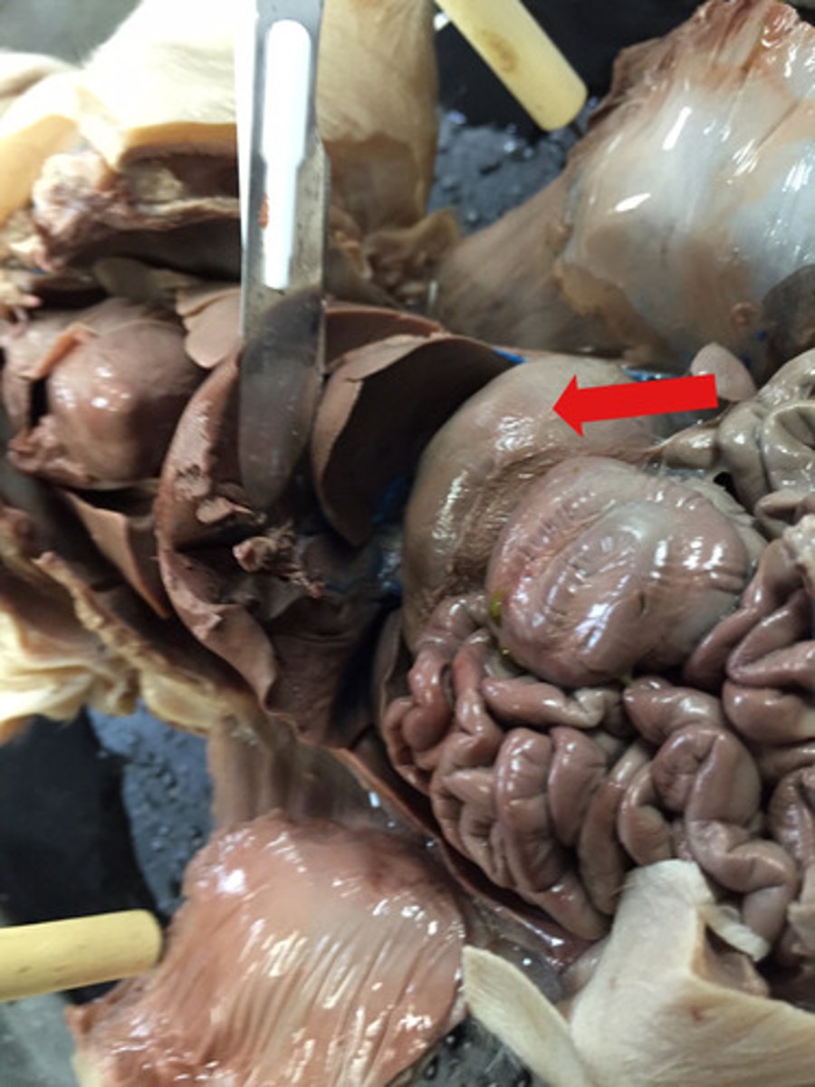 <p>stomach: digestion</p>