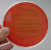 <p>what result on a BAP plate is this</p>