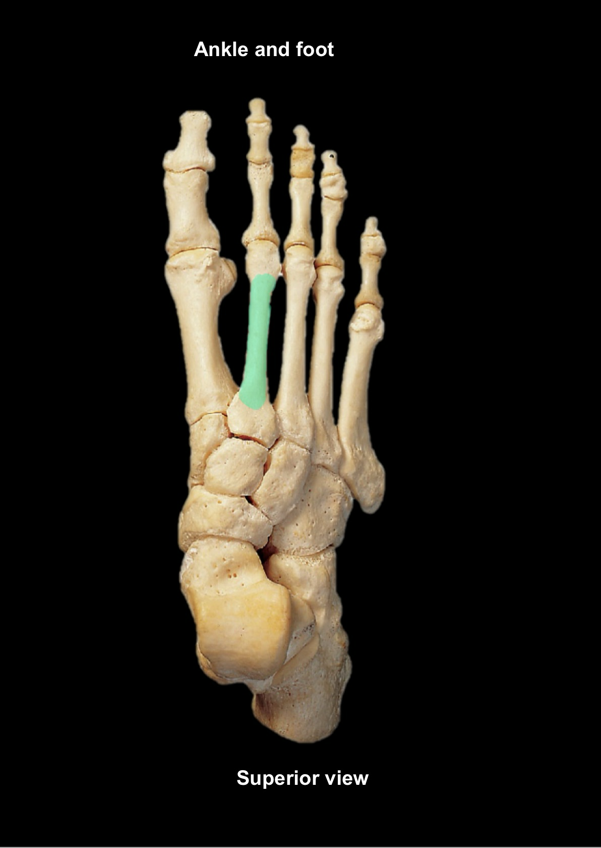 term image