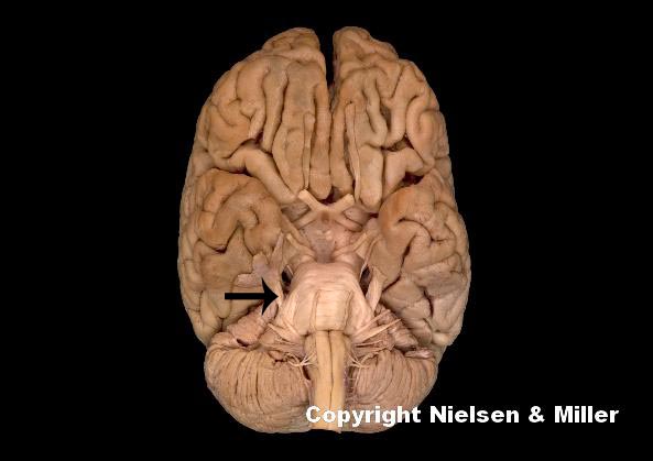 <p>what is indicated nerve</p>