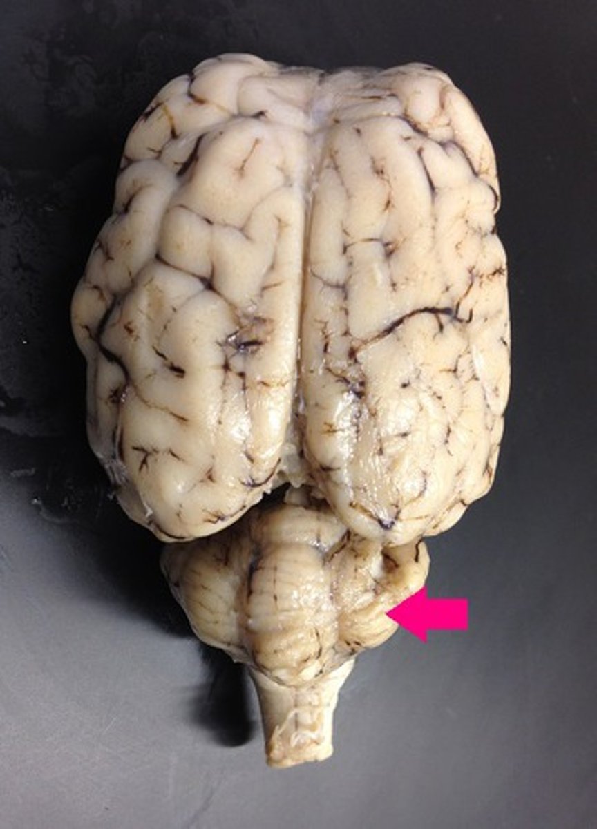 <p>Identify the major brain region.</p>