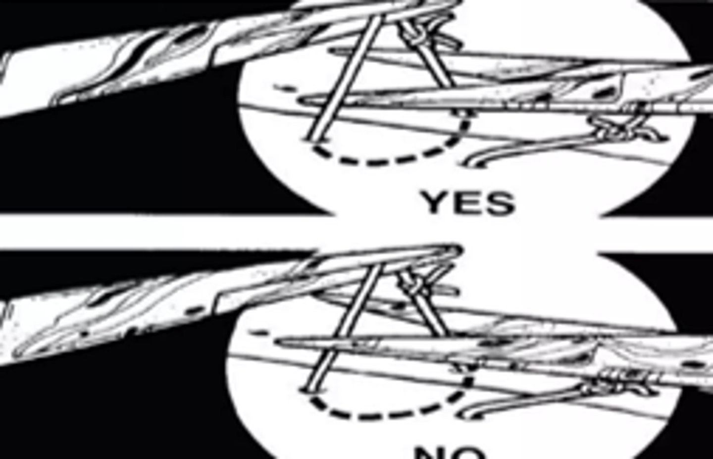 <p>Face: 3-5 days</p><p>Lip: 3-5 days</p><p>Oral cavity: 6-8 days</p><p>Neck: 5-6 days</p><p>Scalp: 7-10 days</p><p>Chest: 10-14 days</p><p>Abdomen 10-14 days</p><p>Leg: 10-14 days</p>