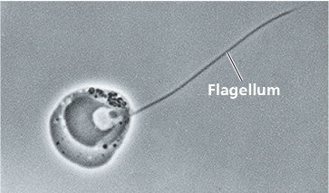 <ul><li><p>Phylum Chytridomycota</p></li><li><p>unicellular</p></li><li><p>aquatic</p></li><li><p>flagellated zoospores</p></li></ul><p></p>