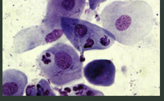 <p>What cell dis</p>