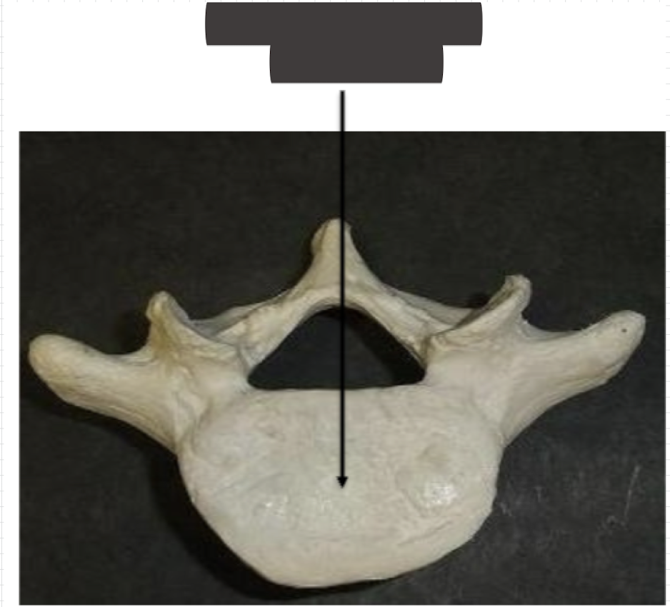 <p>Name this vertebra </p>