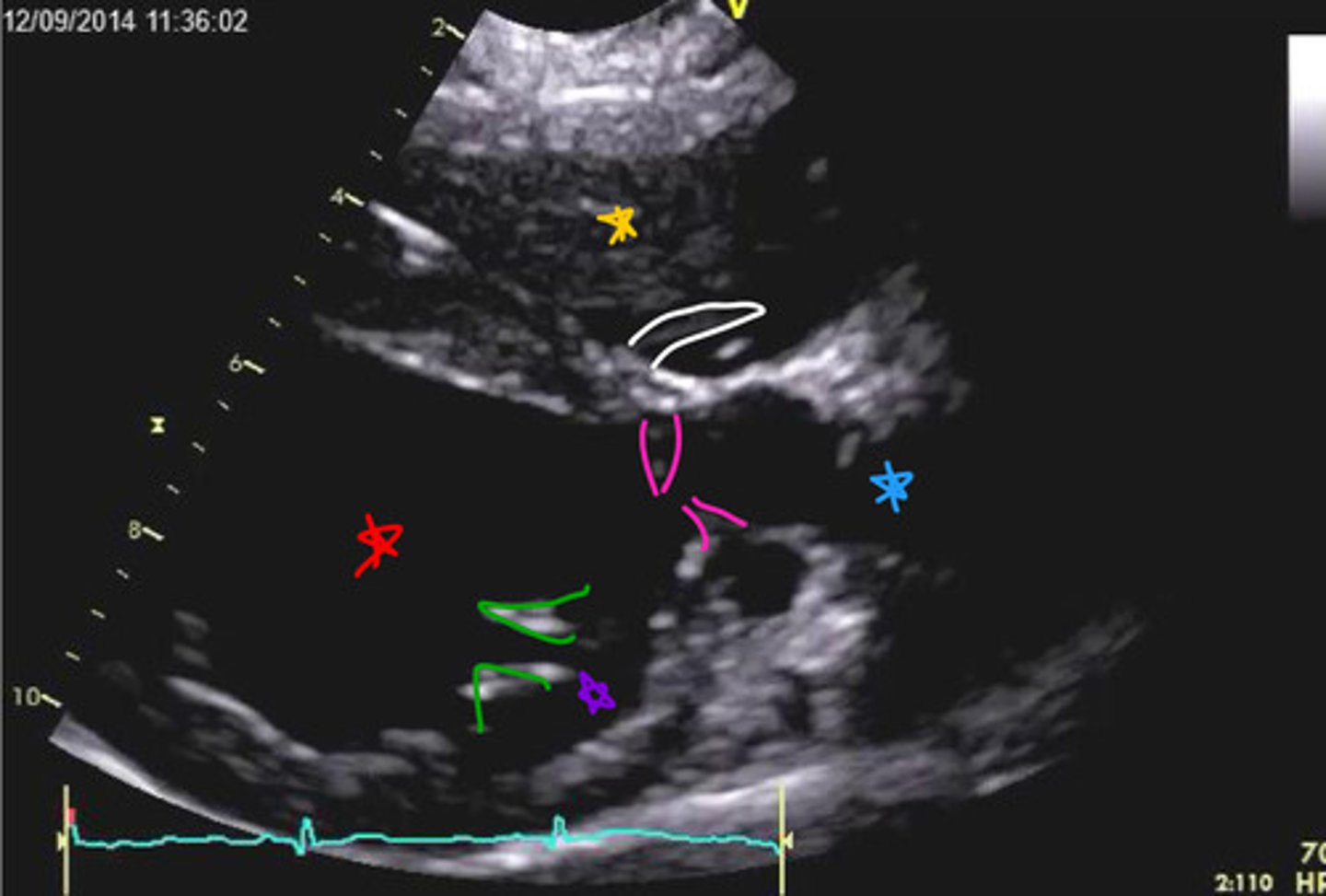 <p>ID parts of heart</p>