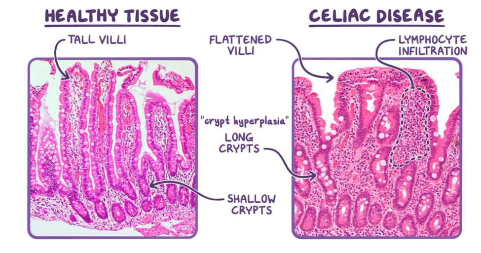 <p>DIAGRAM ON SLIDE 36</p>