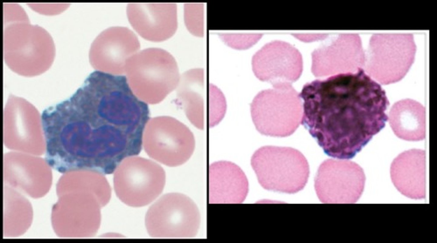 <p>Dark granules- cannot see the nucleus</p><p>least abundant</p><p>allergic reactions</p>