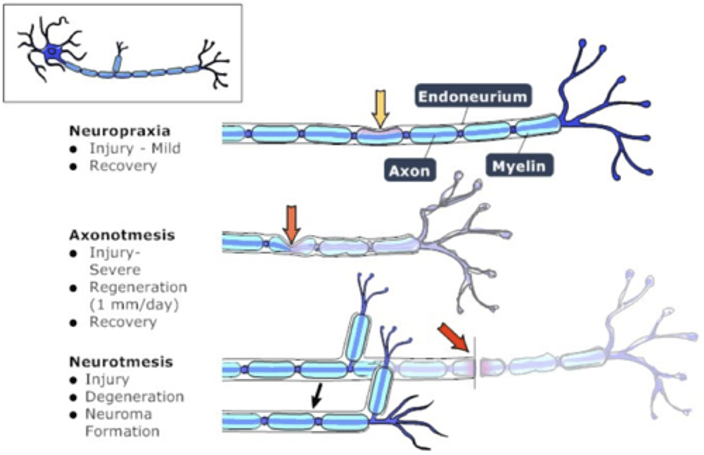 <p>slower transmission</p><p>loose some of the impulses along the way (weaker message)</p>