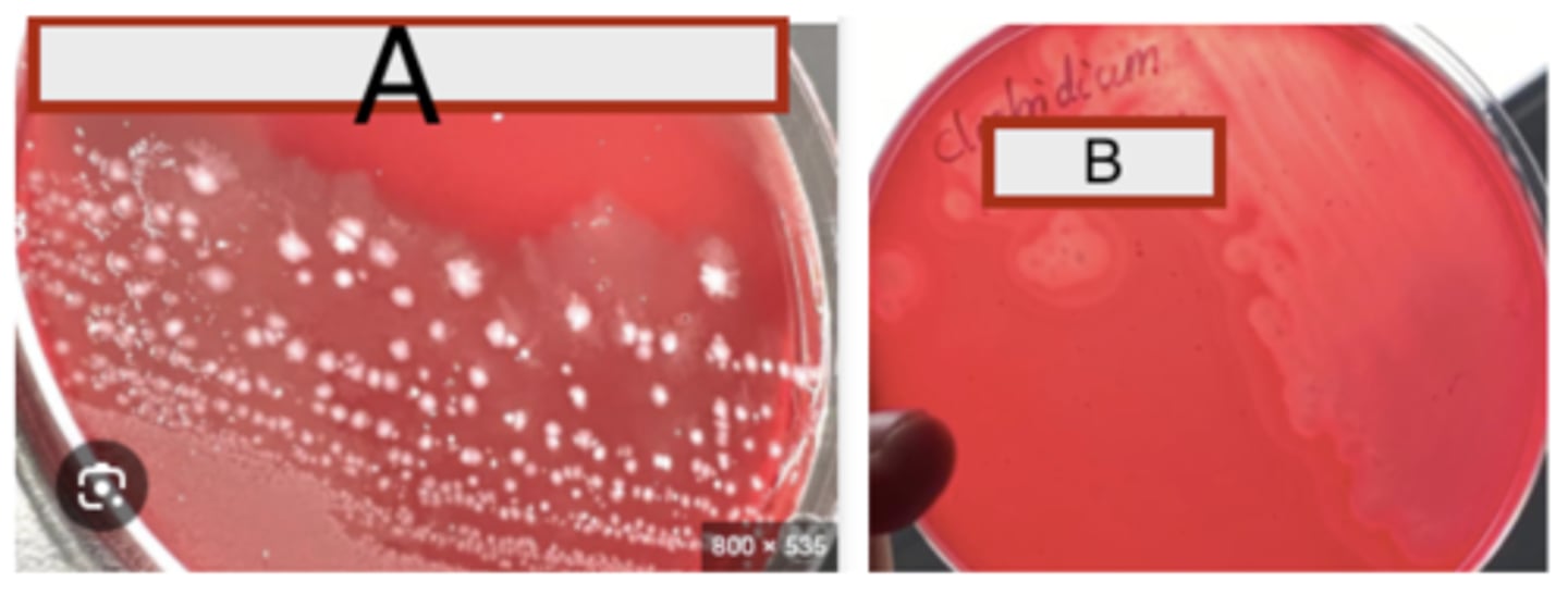 <p>Anaerobic BA cultures are provided of two Clostridium species causing histotoxic clostridial infections</p><p>(myonecrosis and gas gangrene) in animals and humans. Examine the plates provided and describe</p><p>What is you presumptive diagnosis of A + B and Why?</p>