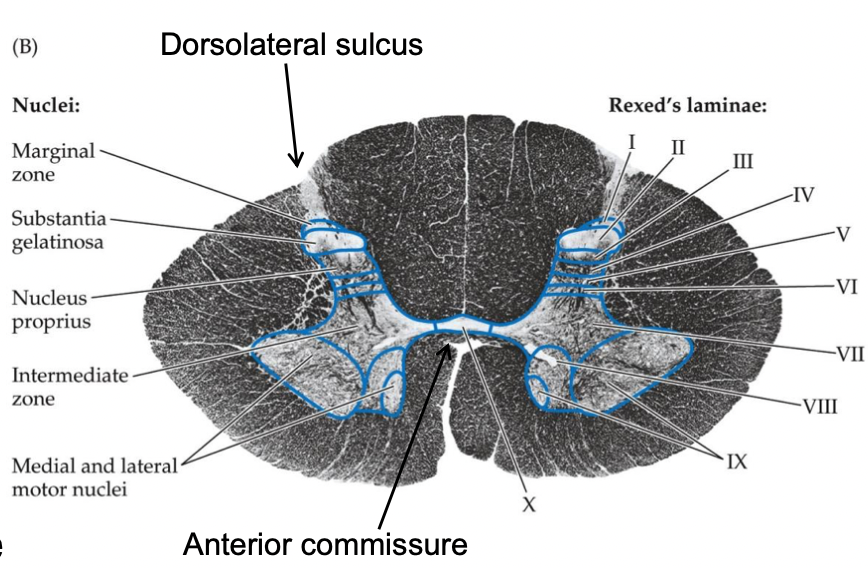 <p>dorsolateral sulcus</p>