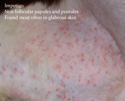 <p><span>Impetigo</span></p>