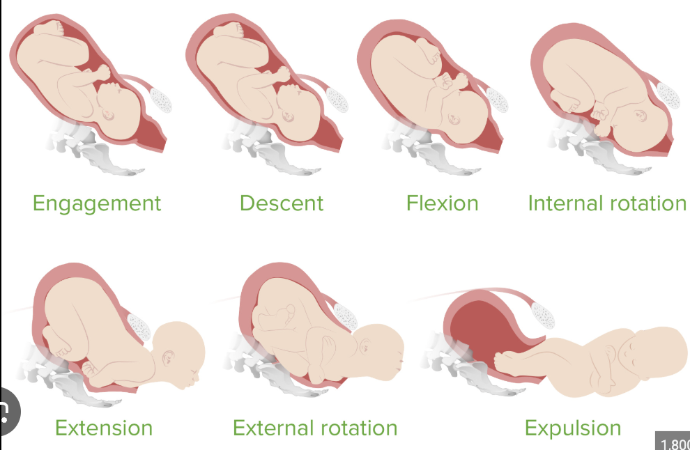 <ul><li><p><span>Engagement</span></p></li><li><p><span>Descent</span></p></li><li><p><span>Flexion</span></p></li><li><p><span>Internal Rotation</span></p></li><li><p><span>Extension</span></p></li><li><p><span>External Rotation</span></p></li><li><p><span>Expulsion</span></p></li></ul><p></p>