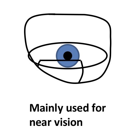 <p>Slightly above the lower limbus of the eye</p>