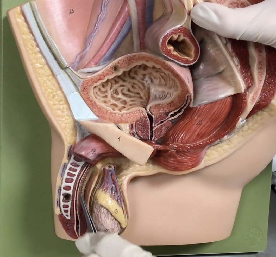 <p>Description: Midline erectile body of the penis</p><p>Relationship: Contains the spongy urethra</p>