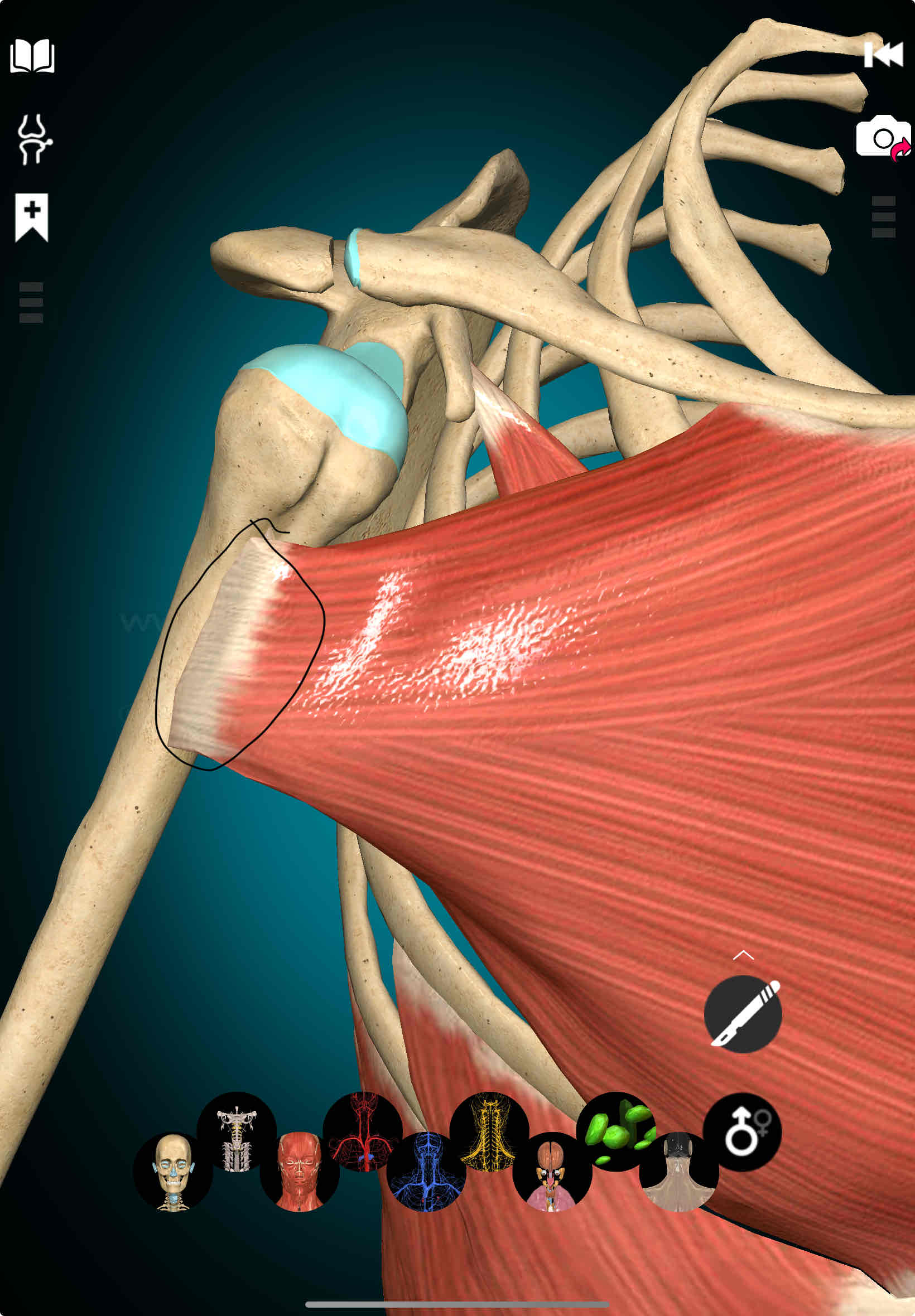 <p>Pectoralis Major Insertion</p>