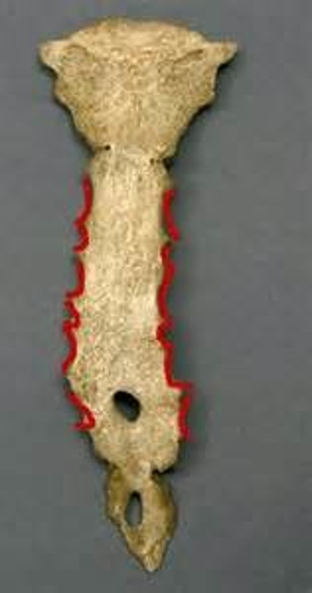 <p>lateral border for ribs 1 and 2</p>