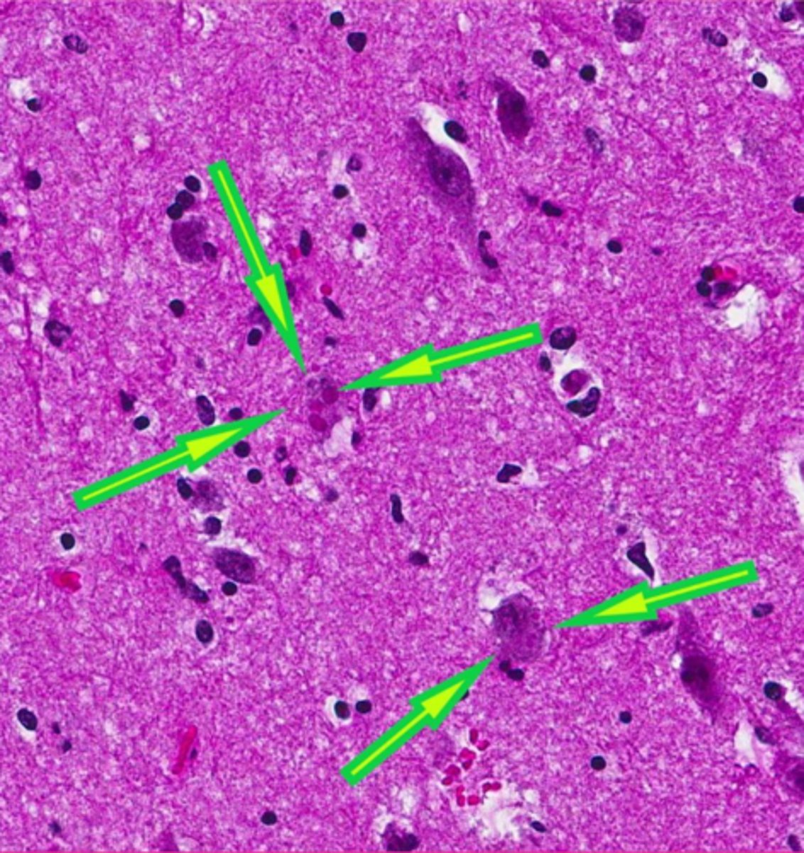 <p>which viral inclusion?</p>
