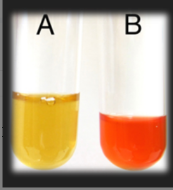 <p>What test is this?</p>