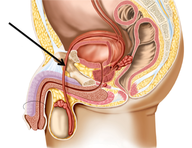-Sperm Duct
-Originates in the Testis
-Tubes that cross the larger ureters and disappears at the base of the urinary bladder
-Part of the Male Reproduction Tract