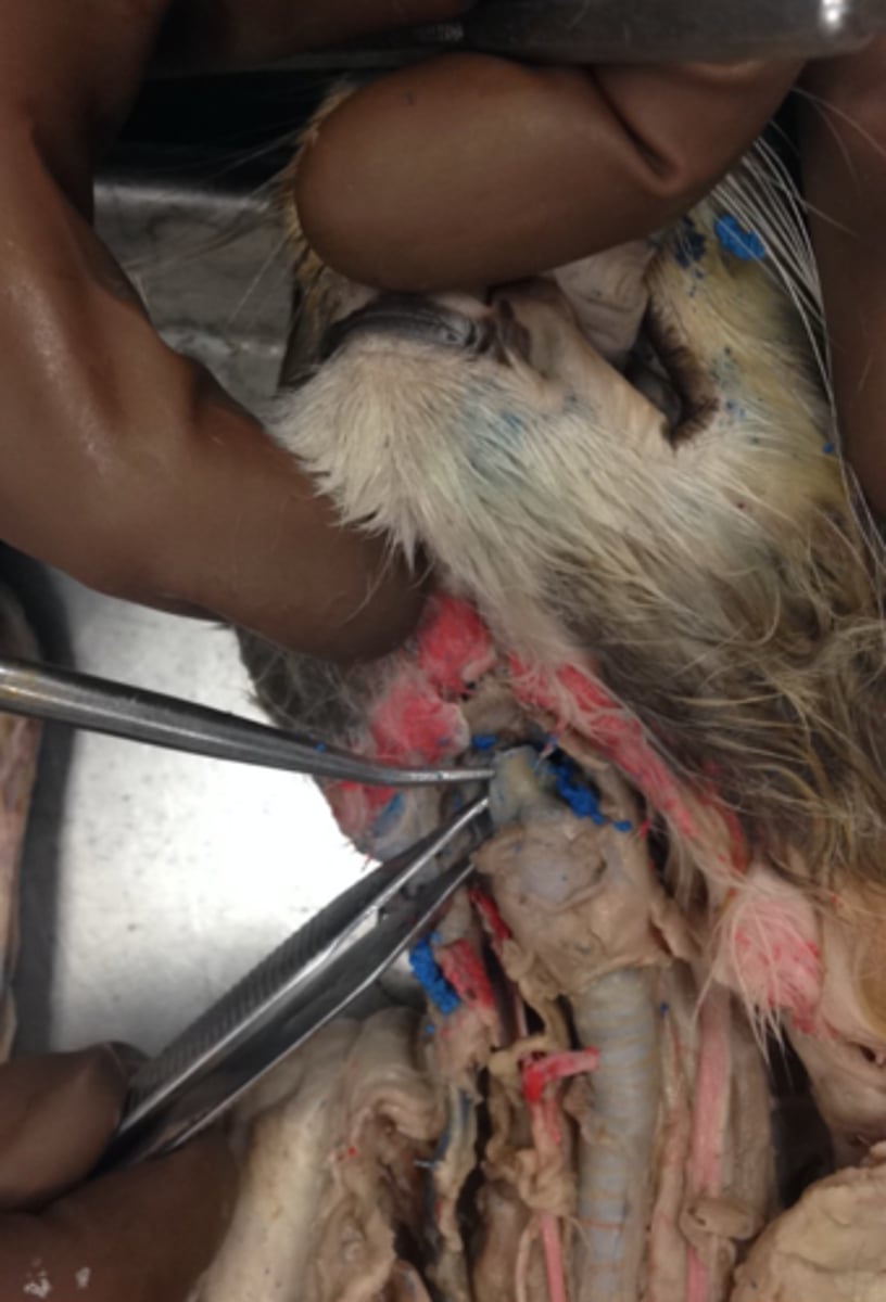 <p>Flap preventing food from entering trachea.</p>