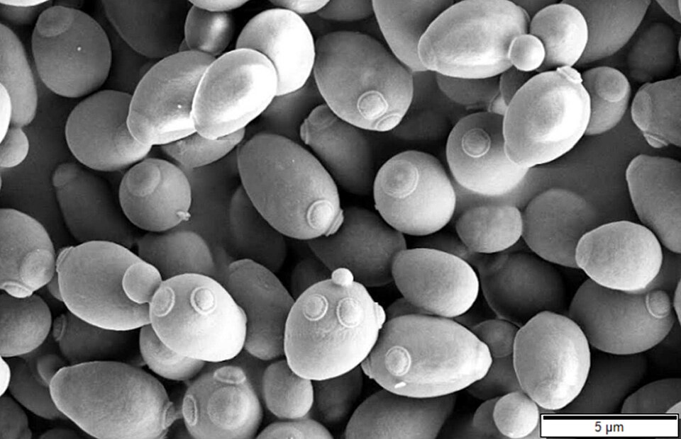 <p>Which fungi is this?</p>