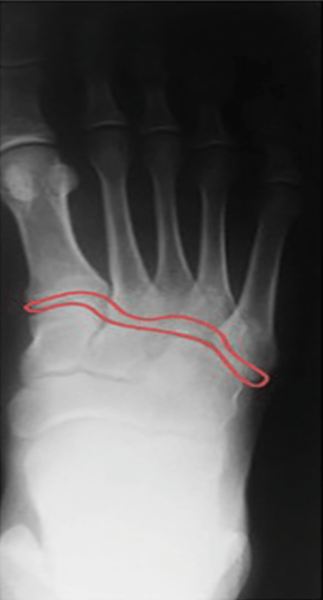 <p>What structure is highlighted?</p>