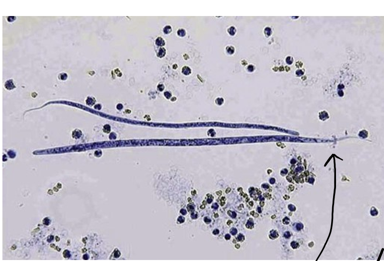 <p>Top and bottom</p>