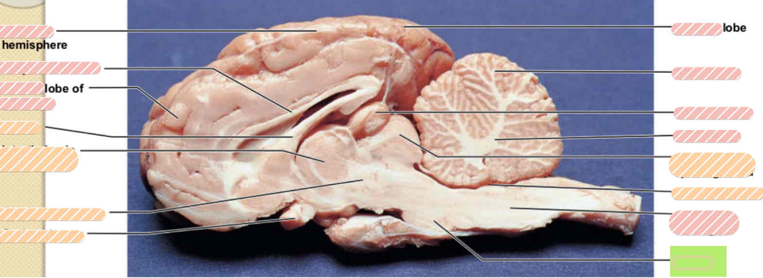 <p><span>Sheep brain</span></p>