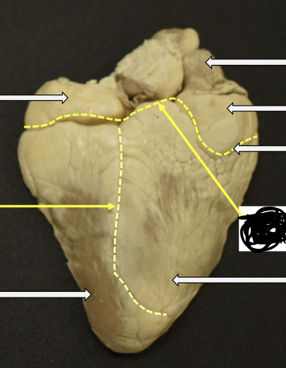 <p>is this the anterior view or posterior view<br>label from top to bottom&nbsp;</p>
