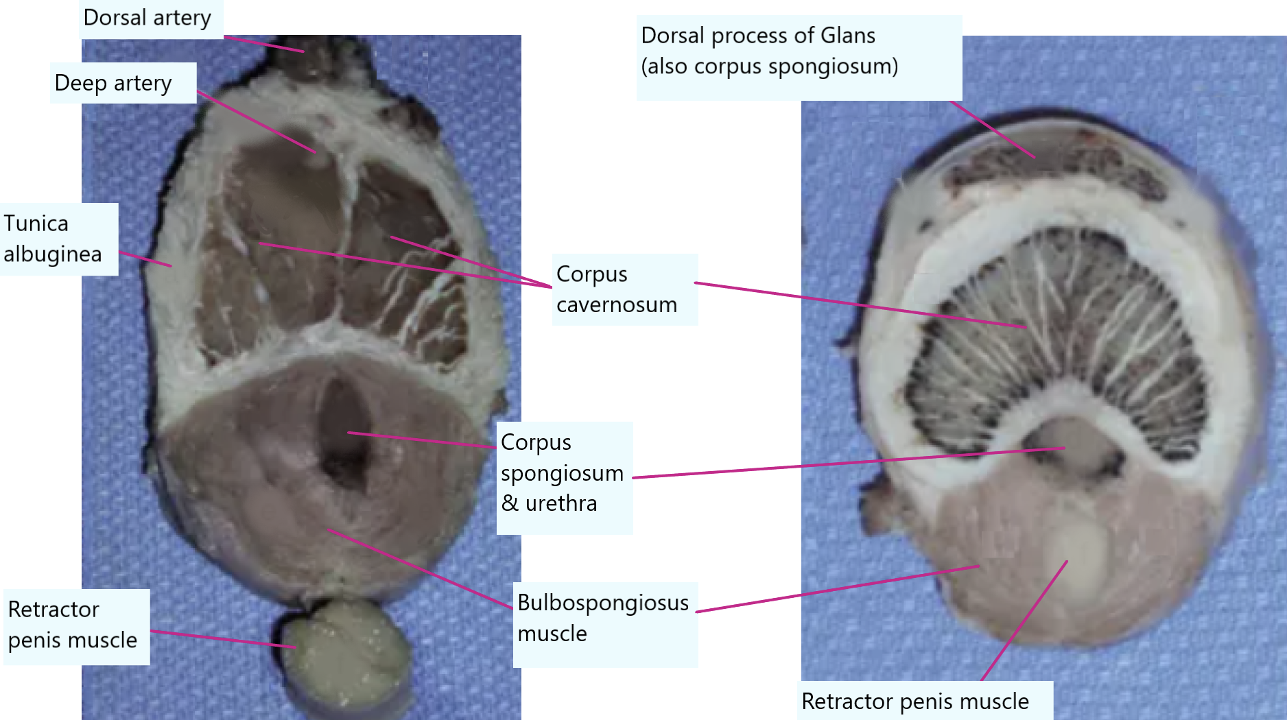 <p>Very similar to canine penis…</p><ul><li><p>Paired crura of corpus cavernosum forming the body dorsally… corpus spongiosum surrounding urethra ventrally</p><ul><li><p>Corpus spongiosum is also supported underneath by <strong>bulbospongiosus muscle</strong></p></li></ul></li></ul><p></p><p>Big difference: <strong>retractor penis muscle underneath</strong></p><ul><li><p>Eventually fuses as we move farther down the penis </p></li></ul><p></p><p>As we move farther down penis, crura fuse together as well… dorsal process of the glans also starts to be seen (made of corpus spongiosum as well)</p><p></p>