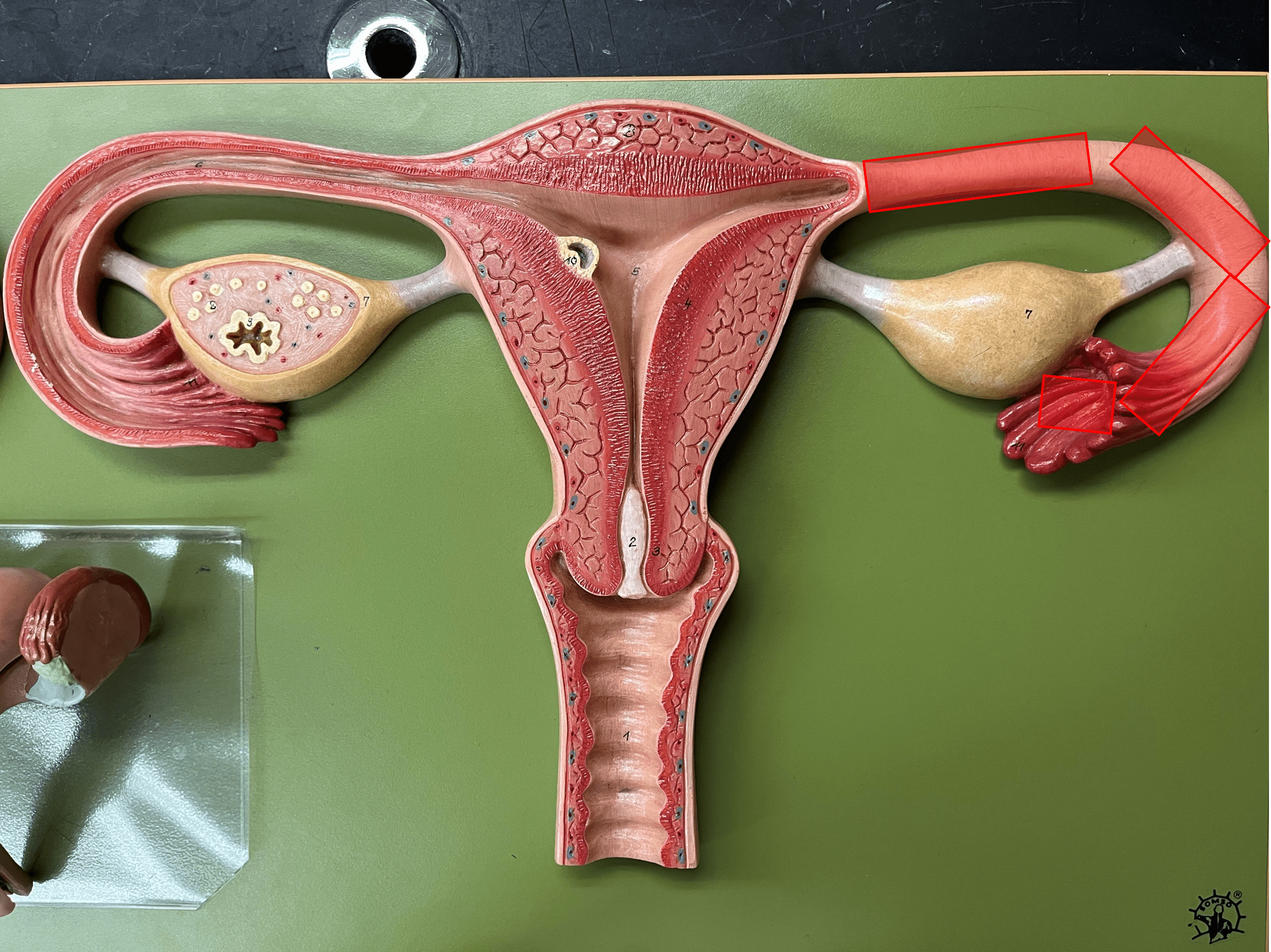 • A narrow tube extending from the uterus to each ovary.

• Attached to the pelvic wall by the broad ligament.

• Composed of an infundibulum, ampulla, and isthmus regions.

• Also known as an oviduct or fallopian tube.