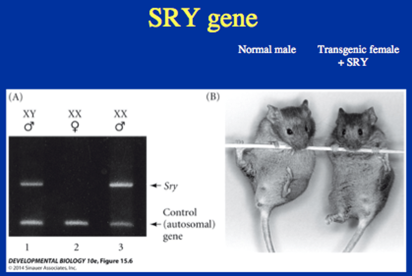 <p>(A) SRY</p><p>The SRY gene is considered the "on-off switch" that, when activated, will trigger testis development in the embryo</p>