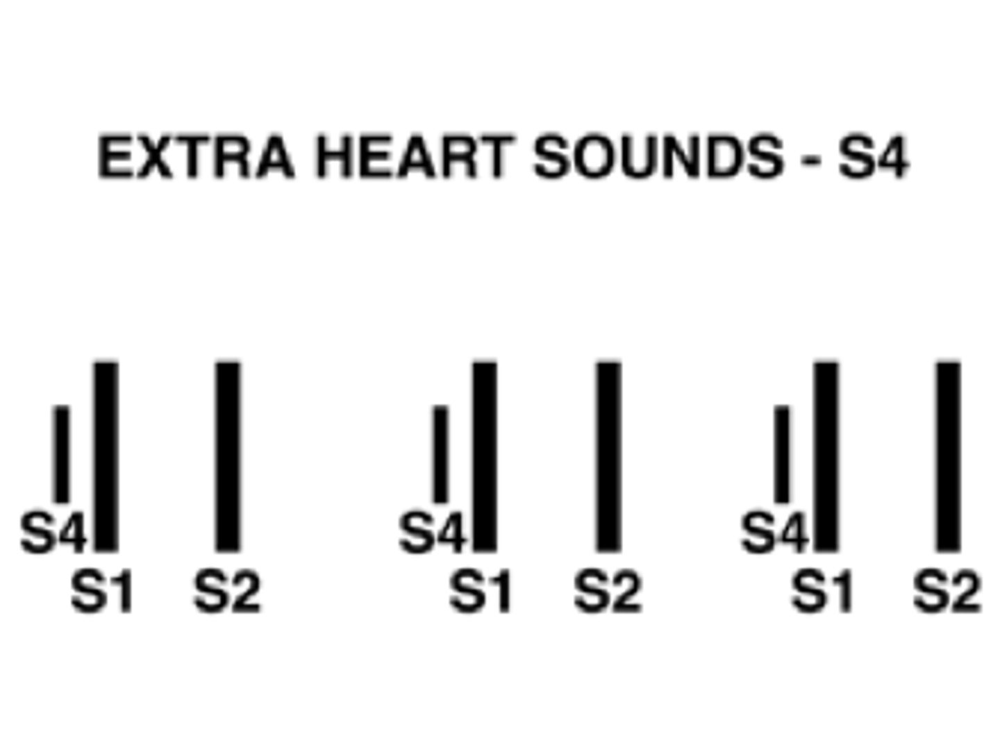 <p>(la-lub-dub)—atrial contraction; late in diastole</p><p>“atrial gallop”—not normal; associated with increased resistance to ventricular filing</p><p>-Hypertension</p><p>-Ventricular hypertrophy</p><p>-Stenosis</p>