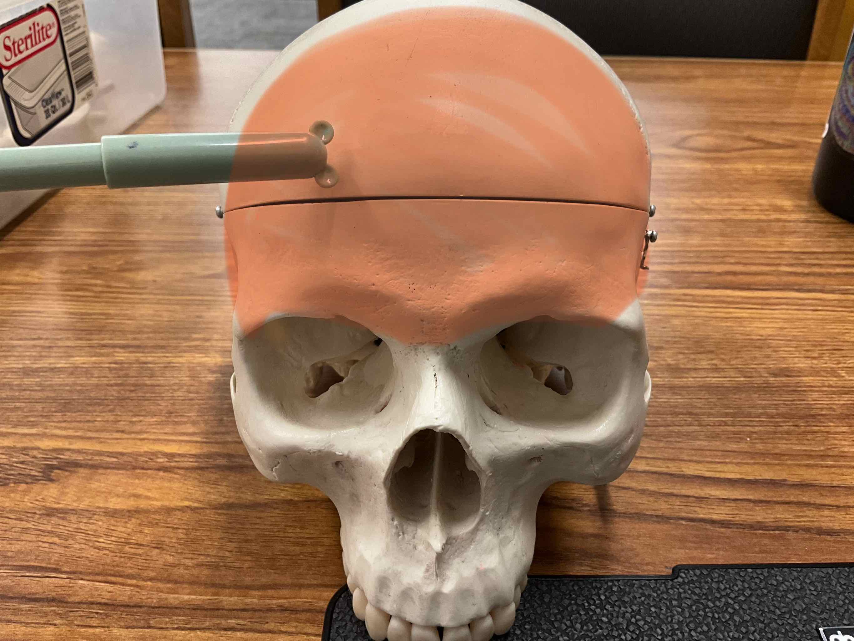 <p>Name the bone</p>