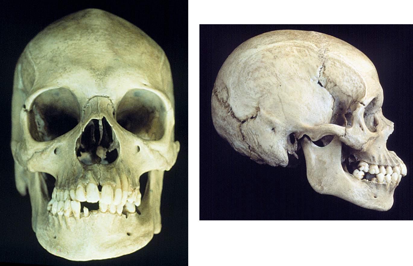 <p><span>What is the ancestry of this skull? </span></p>