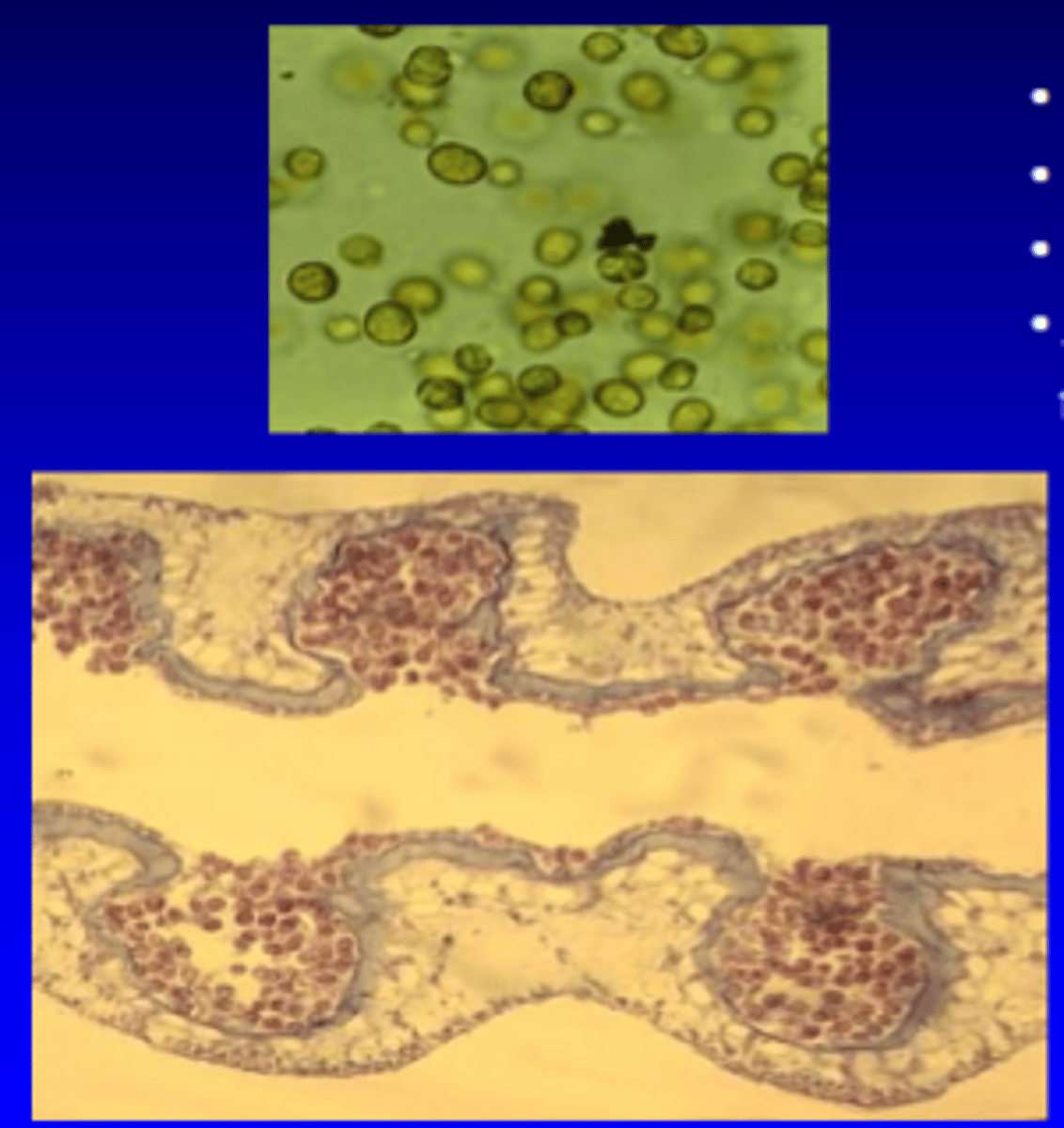 <p>- coccoid stage, nonmotile (lack flagella)</p><p>- Ch a, c; peridinin pigments</p><p>- acquired from environment or maternally transmitted through eggs/planulae larva</p>