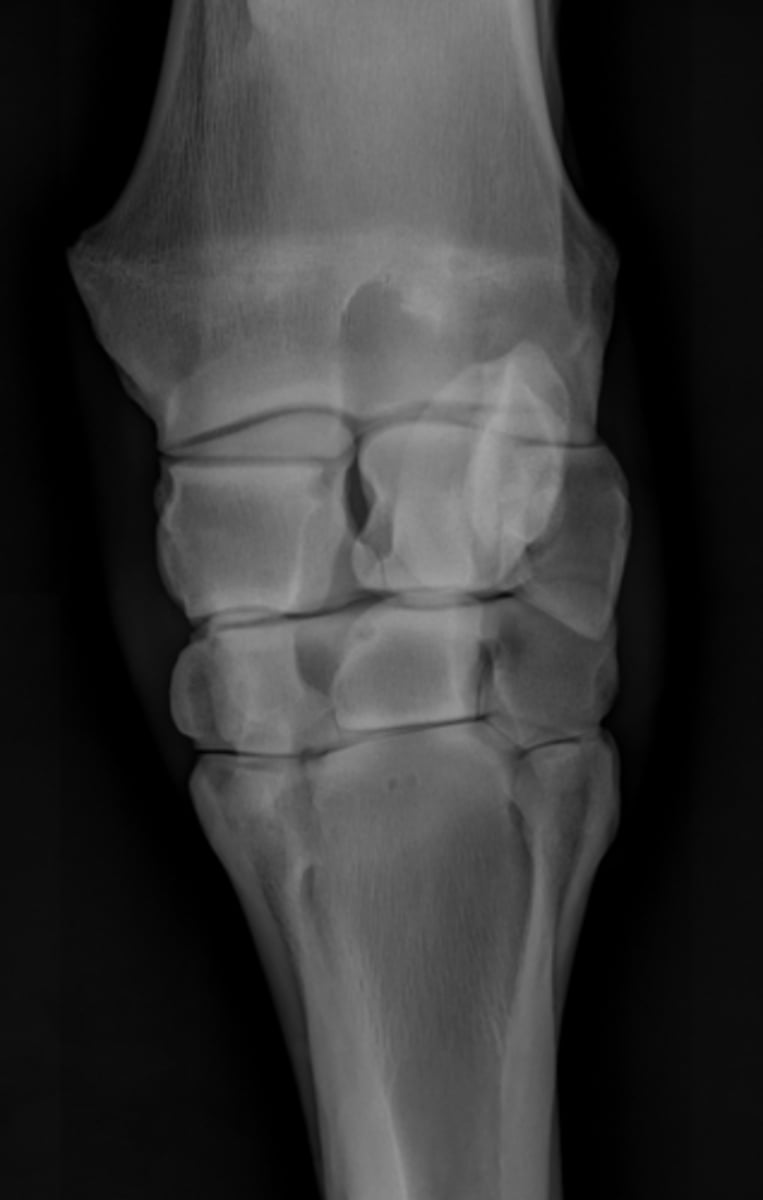 <p>ID joint and view</p>