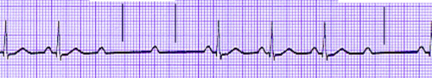 <p>Name the rhythm</p>