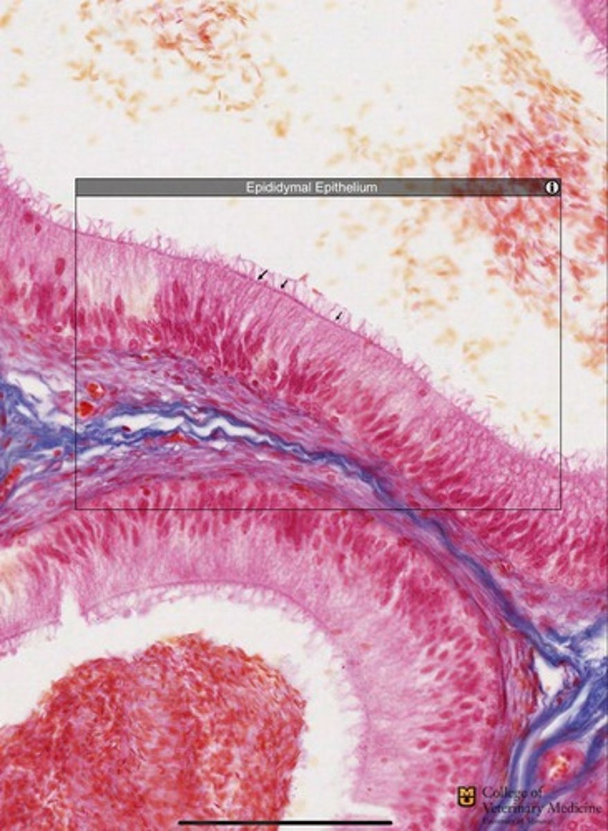 <p>What epithelium type is present and what structure accompanies it?</p>