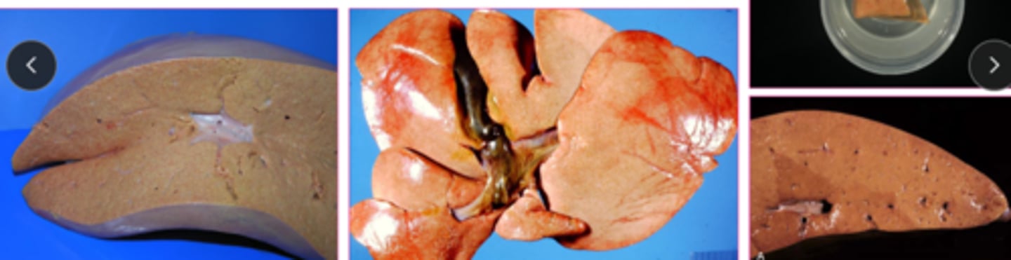 <p>organ is swollen, yellow, greasy texture, possibly friable, may float</p>