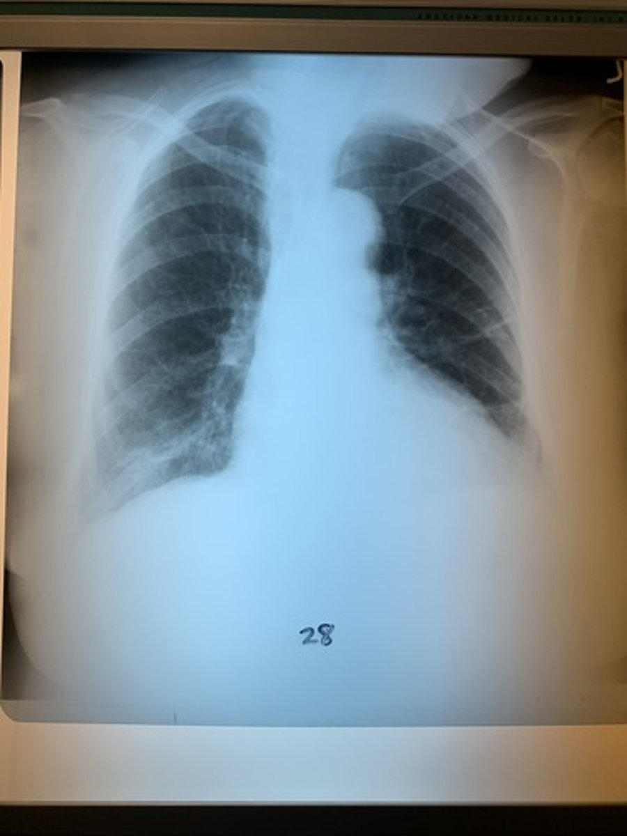 <p>Not penetrated</p><p>1 multiple choice option</p>