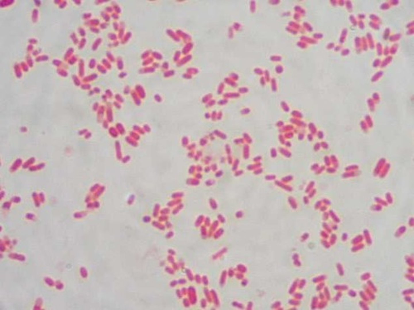 <p>Escherichia coli; Kingdom Eubacteria</p>