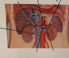 <p>Splenic Artery</p>