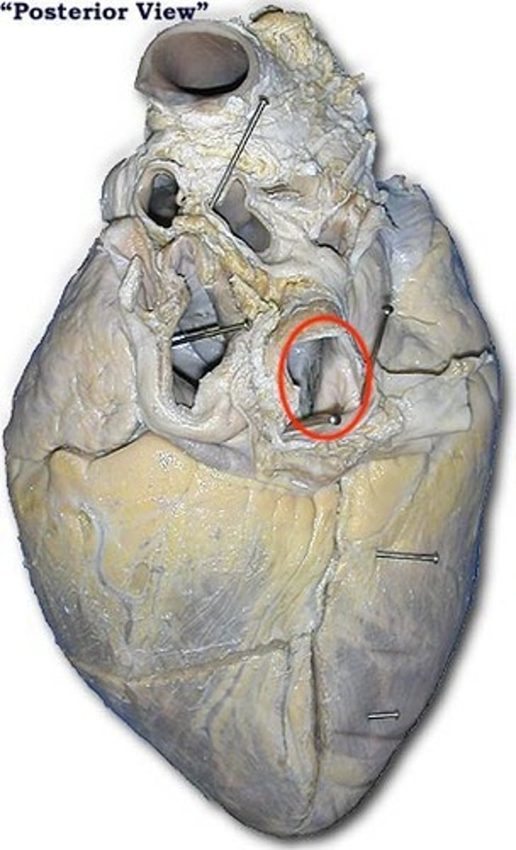 <p>Identify the blood vessel</p>