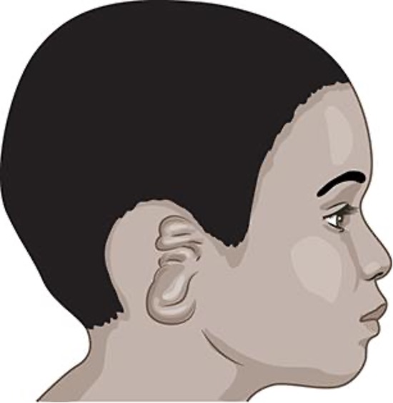 <p>What is the condition or diagnosis called?</p>
