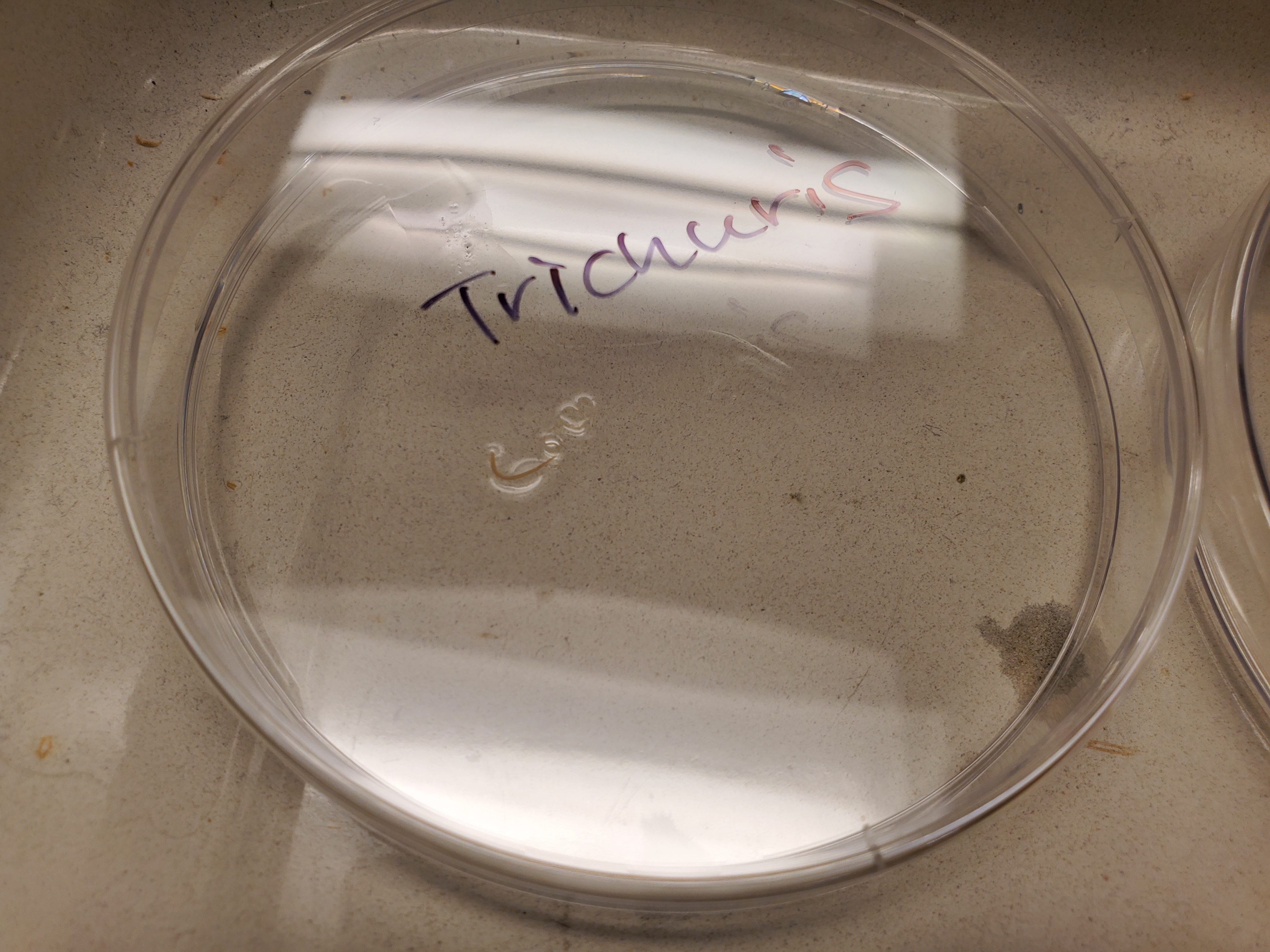 <p>Trichuris</p>