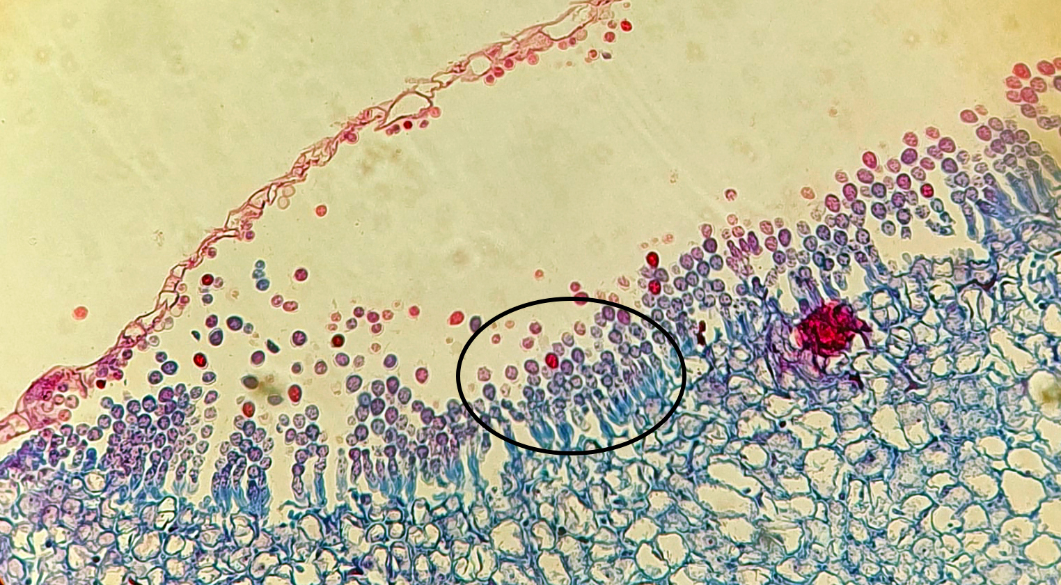 <p>Albugo candida: Vad kallas hela denna struktur?</p>